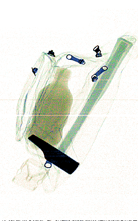 xray_easy00749.png