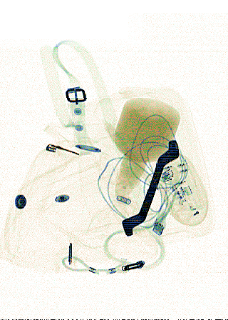 xray_easy03025.png