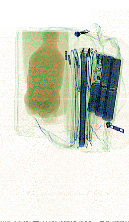 xray_easy01545.png