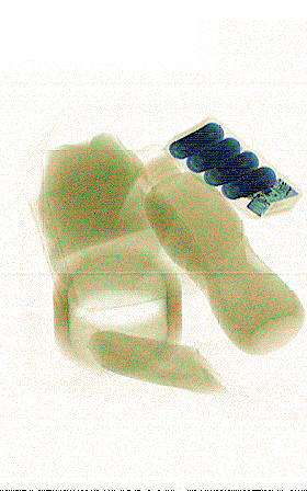 xray_easy01505.png