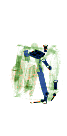 xray_easy04714.png