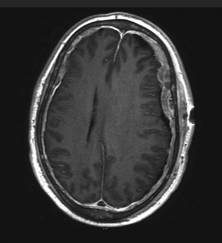 mri1029.jpg