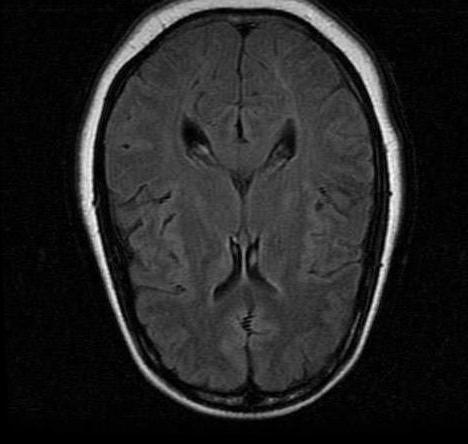 mri1039.jpg