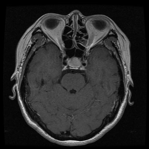 mri1060.jpg