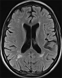 mri1068.jpg