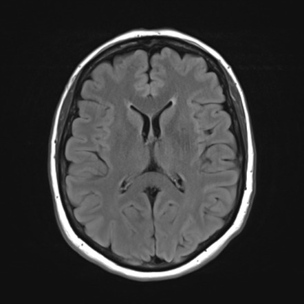 mri1110.jpg