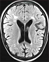 mri1118.jpg