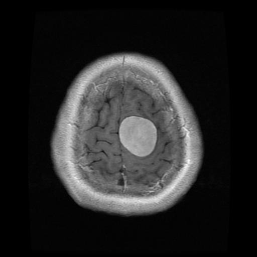 mri1120.jpg