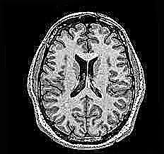 mri1138.jpg