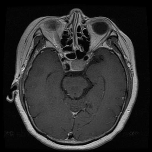 mri1148.jpg