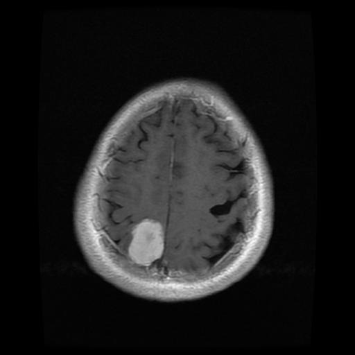 mri1014.jpg