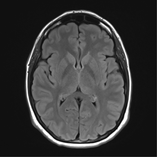 mri1022.jpg