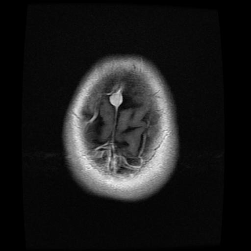 mri1034.jpg