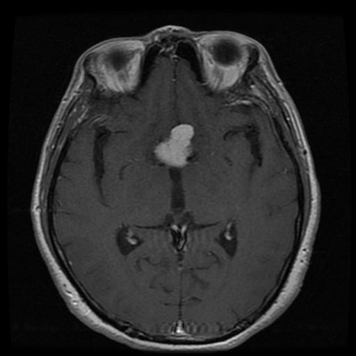 mri1035.jpg