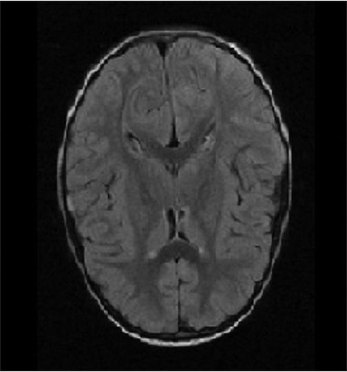 mri1041.jpg