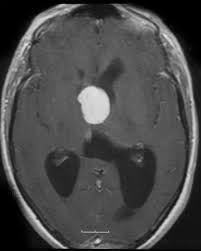 mri1055.jpg