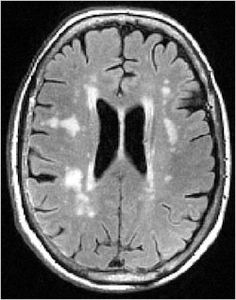 mri1061.jpg