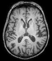 mri1020.jpg