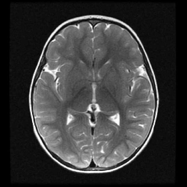 mri1038.jpg