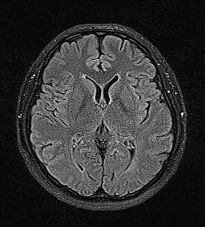 mri1079.jpg