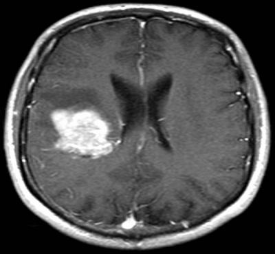 mri108.jpg