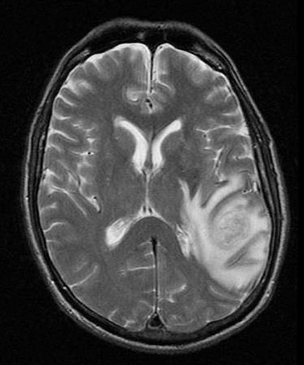 mri1080.jpg