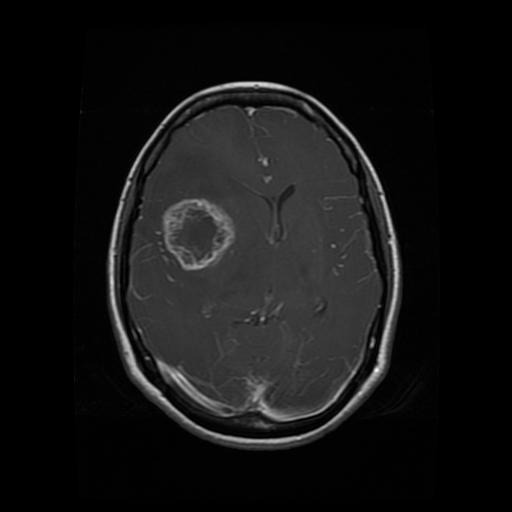 mri1128.jpg