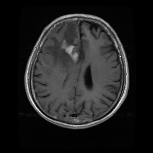 mri1129.jpg