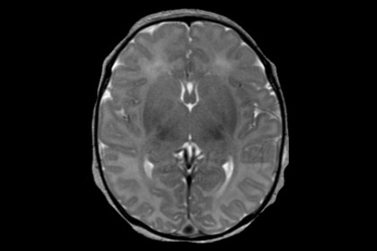 mri1140.jpg