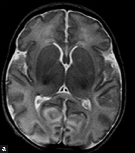 mri1001.jpg