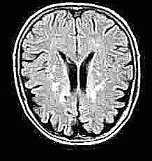 mri1002.jpg