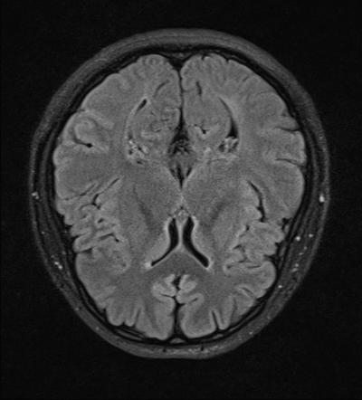 mri1025.jpg