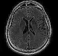 mri1052.jpg